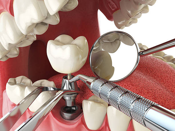 Best Orthodontic Emergency Dentist in Berwyn Heights, MD